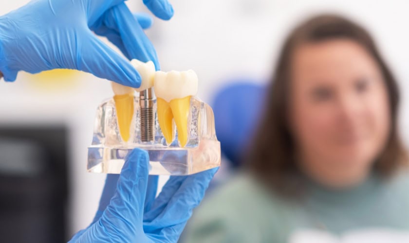 dental implants in west seattle