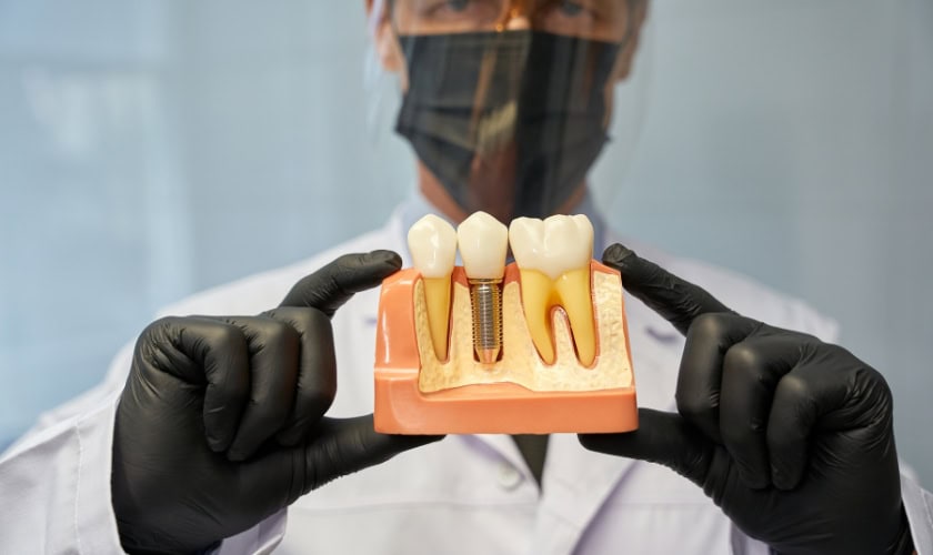 dental implants tips for west seattle