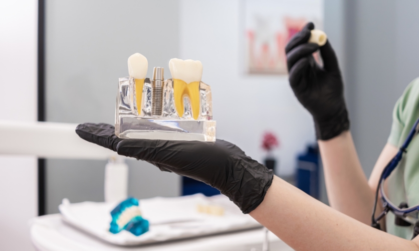 Managing Swelling And Bruising After Dental Implant Surgery: Tips from Dr. Niki Johnston