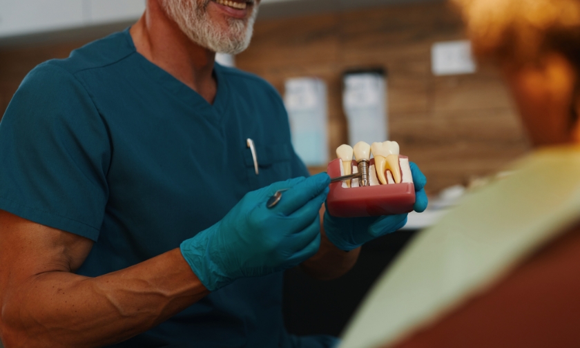 Dental Implants at 80: Benefits and Success Rates