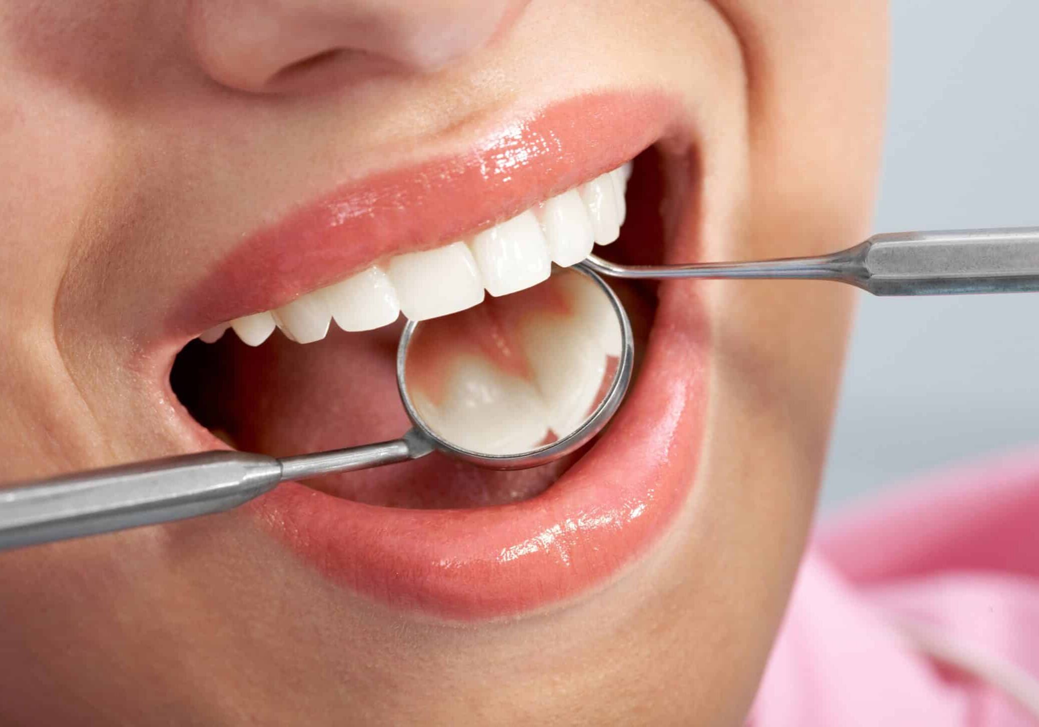 Close-up of patients open mouth during oral checkup with mirror and hook